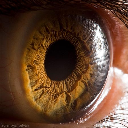 eye2
